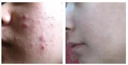 皮肤管理培训,皮肤管理培训机构 皮肤管理培训,皮肤管理培训机构